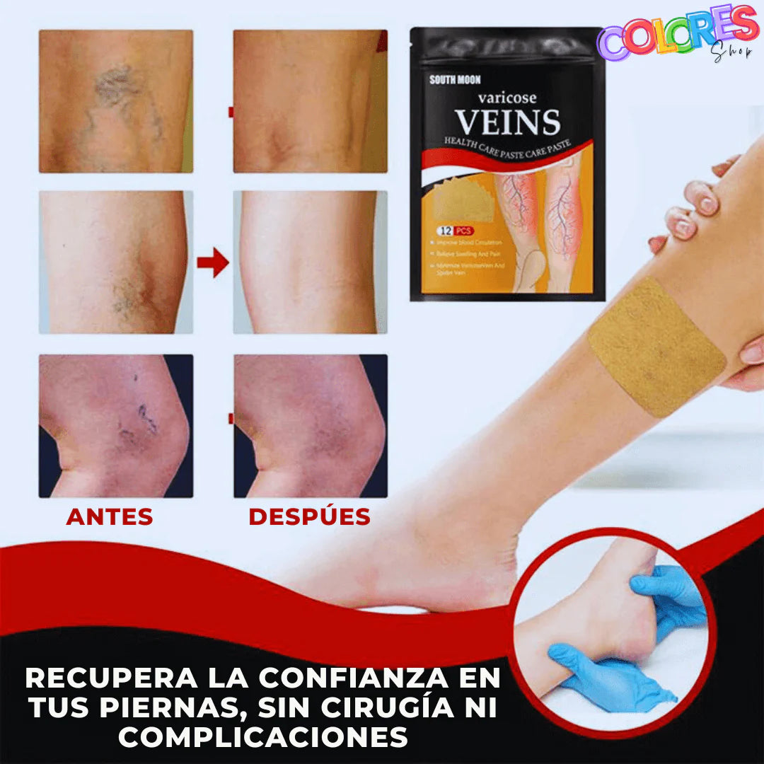 Parches Naturales para Varices y para las Piernas Cansadas - VeinPatch™