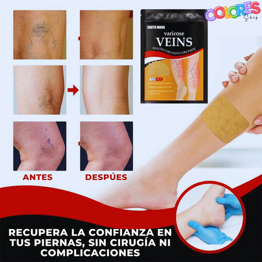Parches Naturales para Varices y para las Piernas Cansadas - VeinPatch™
